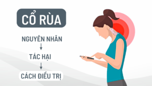tình trạng cổ rùa